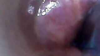 Endoscope POV: Test Tube Cock Urethral Insertion