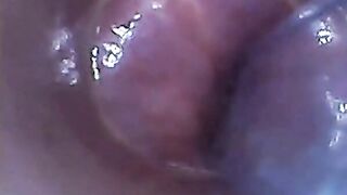 Endoscope POV: Test Tube Cock Urethral Insertion