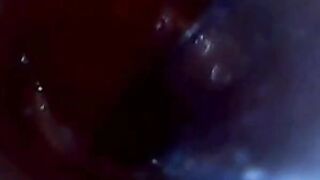 Endoscope POV: Test Tube Cock Urethral Insertion