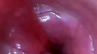 Endoscope POV: Test Tube Cock Urethral Insertion