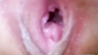 Amateur Russian Anal