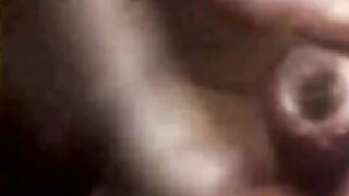 Endoscope POV: Test Tube Cock Urethral Insertion