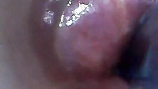 Endoscope POV: Test Tube Cock Urethral Insertion