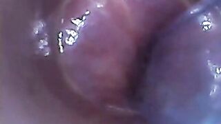 Endoscope POV: Test Tube Cock Urethral Insertion