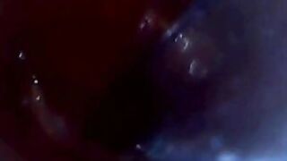 Endoscope POV: Test Tube Cock Urethral Insertion