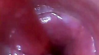 Endoscope POV: Test Tube Cock Urethral Insertion