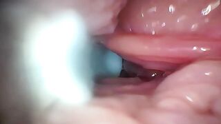 Semen in Cervix Wide Stretching Pussy Endoscope!