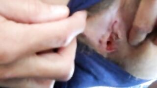 Hairy pussy girl gets fucked and filled with cum