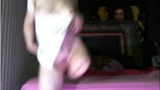 Hairy Amputee with Big Tits on Webcam